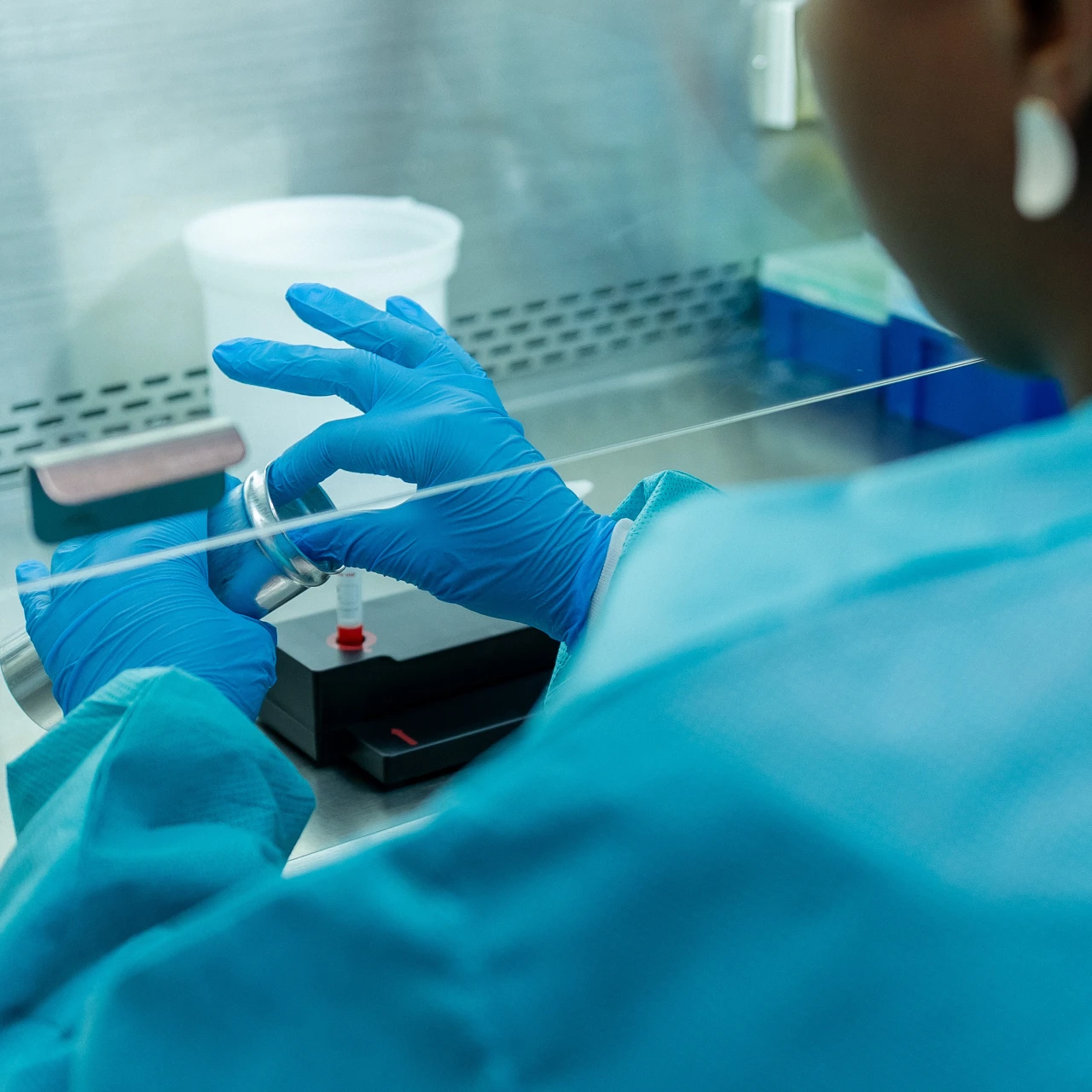 SZO: Obim epidemije ebole u Kongu veći nego što pokazuju zvanične brojke